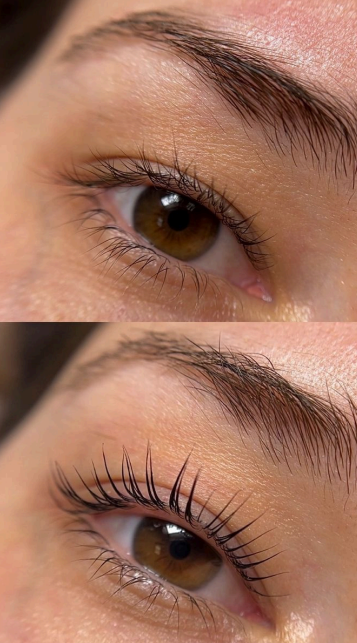 Example de rehaussement